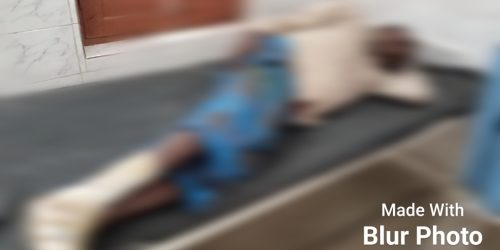 ମଦନପୁର ମୁଖ୍ୟ ରାସ୍ତାରେ ମୋଟର ସାଇକେଲ ଦୃଘଟଣା ଗ୍ରସ୍ତ,ଚାଳକ ଗୁରୁତର